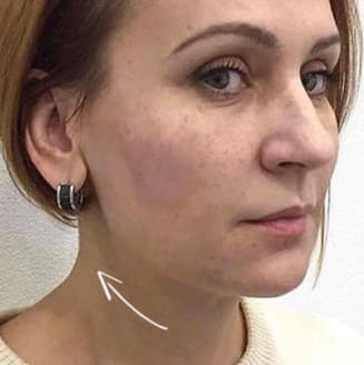 face after