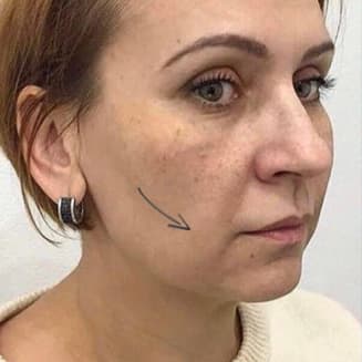 face before